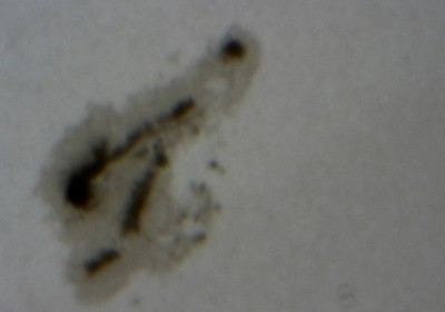 Sonnenfleck